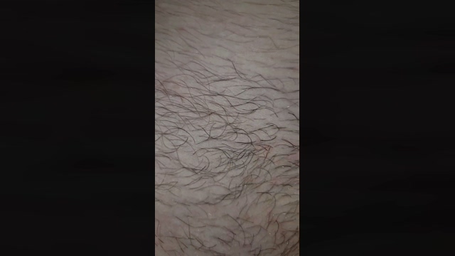 Totolebrow  05-03-2022